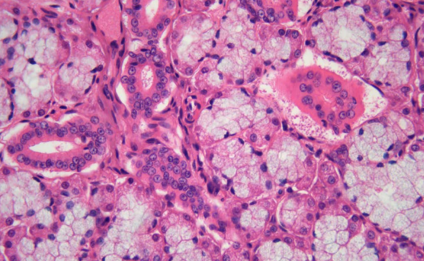 Lumenera INFINITY8-8C USB3 Color Microscope Camera – 8.3MP